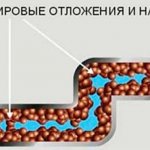 Fat accumulation in the pipe